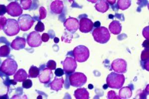 Exciting News – Moving Towards a Cure